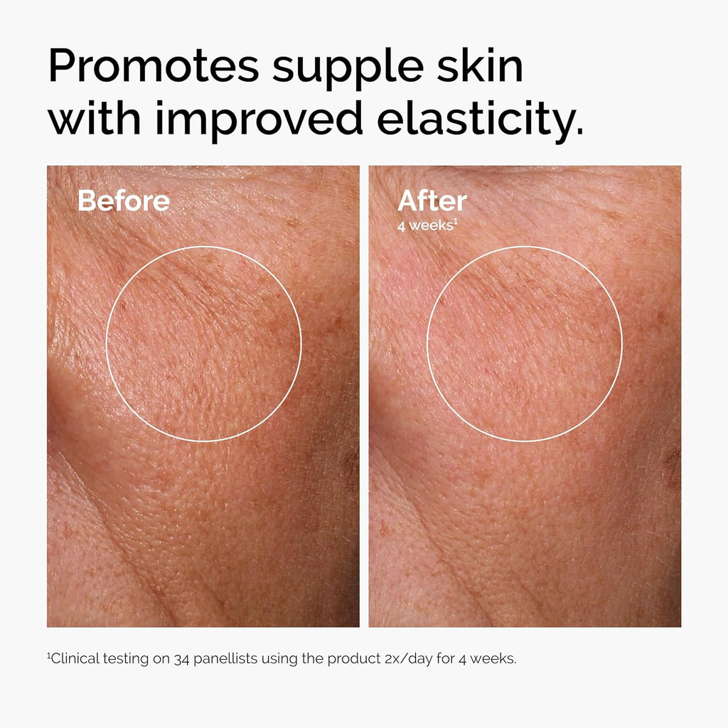 The Ordinary Serum Favorites Set – Hyaluronic Acid 2% + B5, Niacinamide 10% + Zinc 1%, Caffeine Solution 5% + EGCG Eye Serum, Serums for Hydrating, Brightening & Pore-Minimizing Skin Care